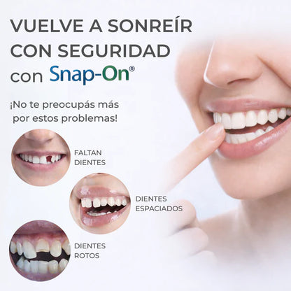 SNAP SMILE™ CARILLAS DENTALES REMOVIBLES